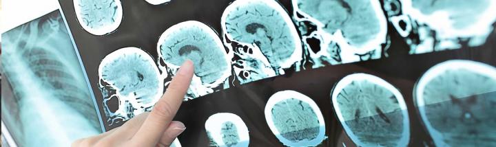 Scheduling a Free Consultation with a Personal Injury Attorney