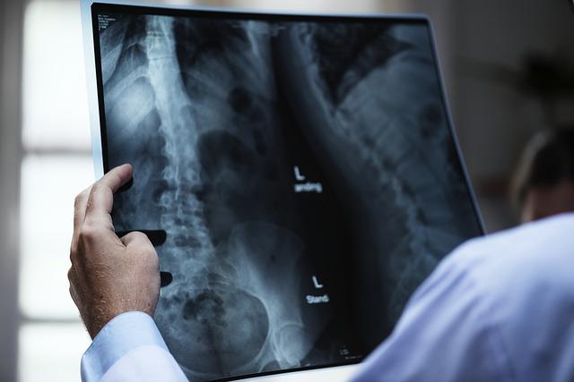 Documents You Need to File a Workers' Compensation Claim  