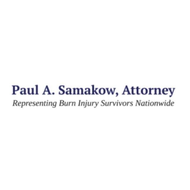 National Burn Attorney